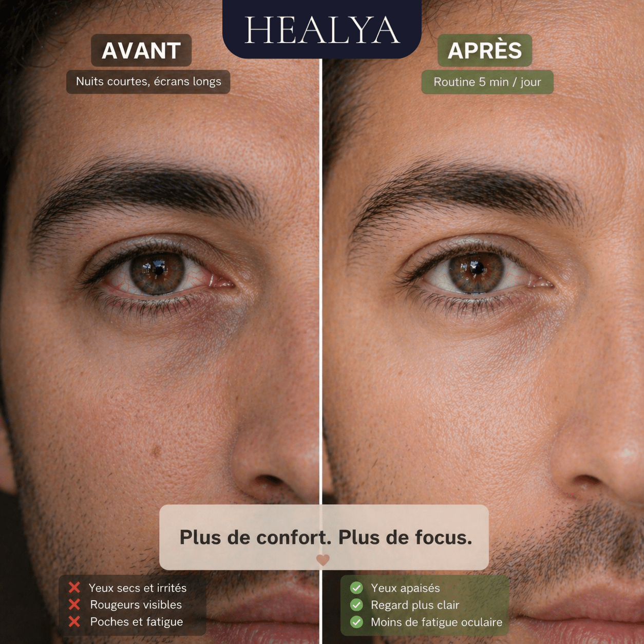HEALYA — Eye Comfort PRO - HEALYA