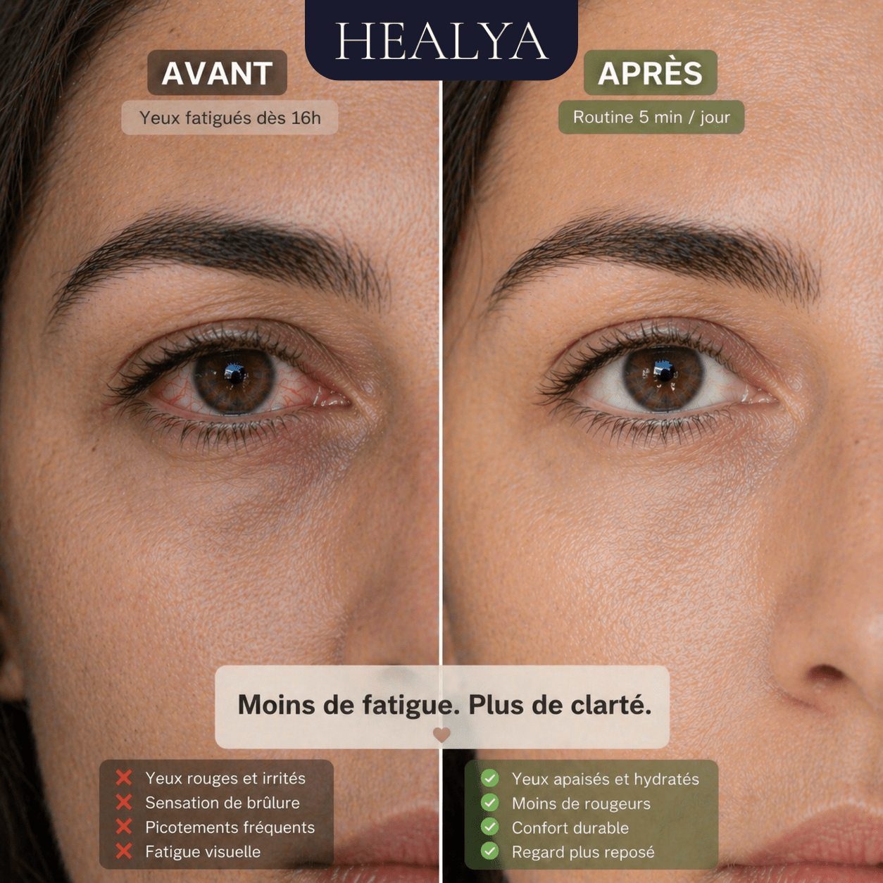 HEALYA — Eye Comfort PRO - HEALYA