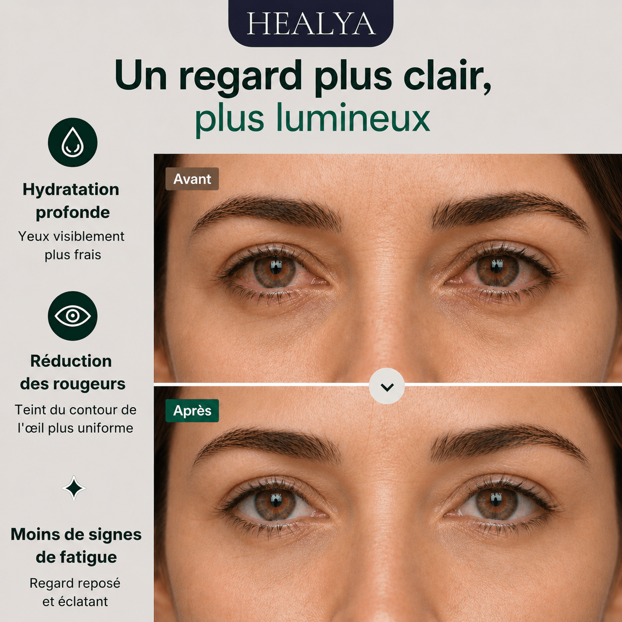 HEALYA — Eye Comfort PRO - HEALYA